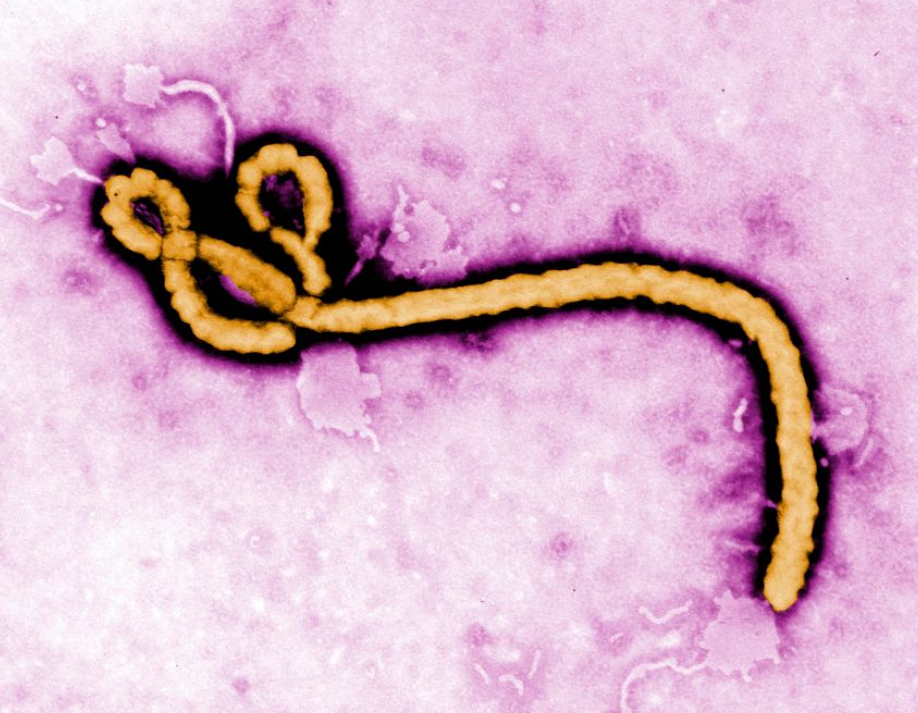 Ebola virus under microscope – Bundibugyo strain